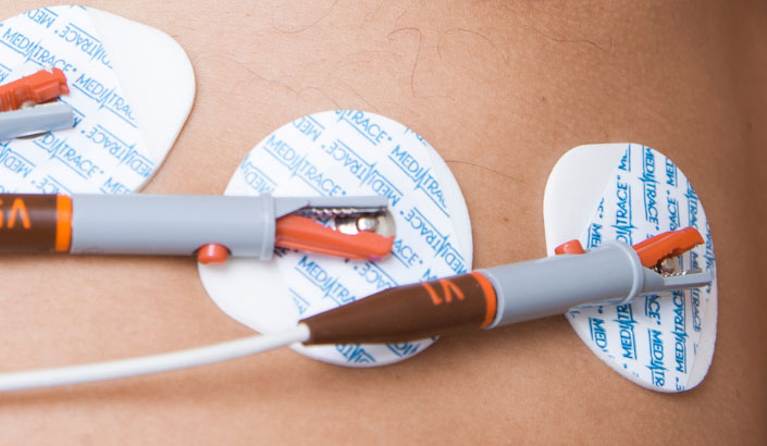 patient monitoring materials converting